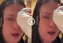Viral Video Today The Woman Put Glue In Her Eyes Instead Of Eye Drops, Then What Happened Next Cannot Even Be Imagined. Watch Video