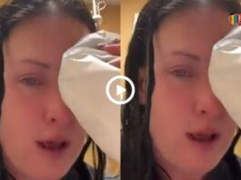 Viral Video Today The Woman Put Glue In Her Eyes Instead Of Eye Drops, Then What Happened Next Cannot Even Be Imagined. Watch Video